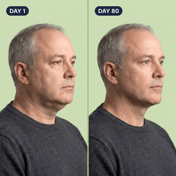 Milk Thistle Liver Detox – 80% Silymarin